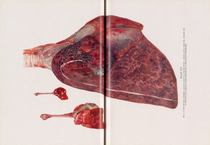 Plate XVI by Milton C. Winternitz