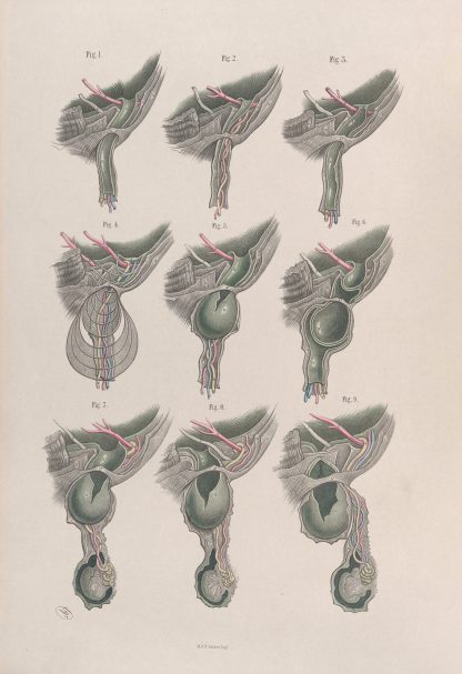 Surgical anatomy Pl.33 by Joseph Maclise