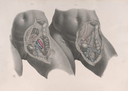 Surgical anatomy Pl.35 by Joseph Maclise