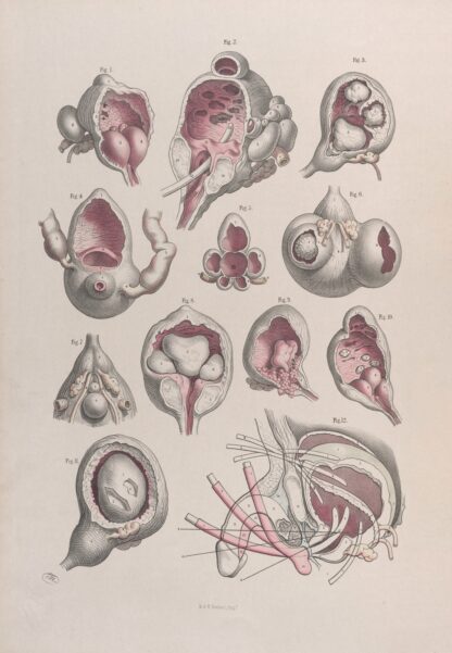 Surgical anatomy Pl.47 by Joseph Maclise