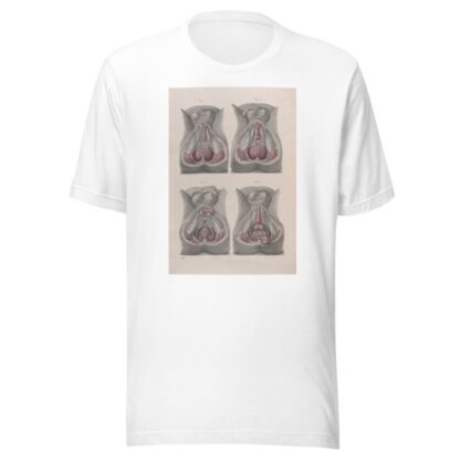 Surgical anatomy Pl.43 by Joseph Maclise T-Shirt