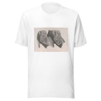 Surgical anatomy Pl.35 by Joseph Maclise T-Shirt