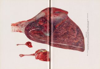 Plate XVI by Milton C. Winternitz