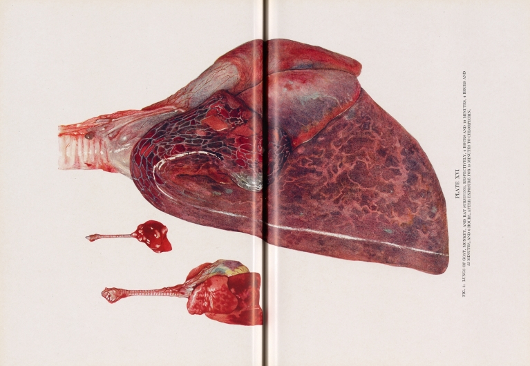 Plate XVI by Milton C. Winternitz