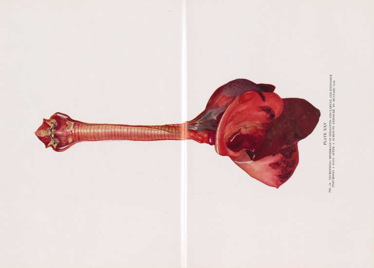 Plate XXV by Milton C. Winternitz