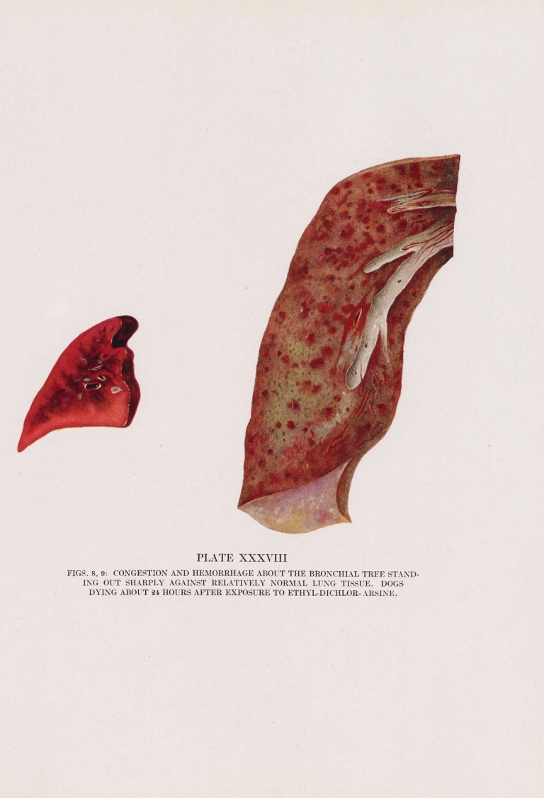 Plate XXXVIII by Milton C. Winternitz