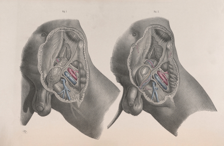 Surgical anatomy Pl.29 by Joseph Maclise