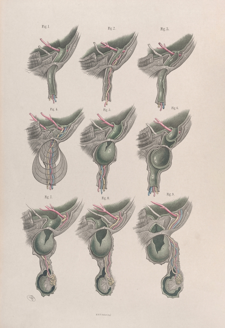 Surgical anatomy Pl.33 by Joseph Maclise
