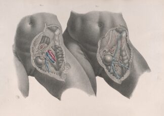 Surgical anatomy Pl.35 by Joseph Maclise