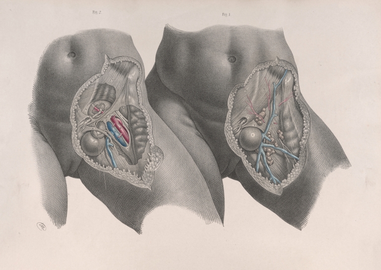 Surgical anatomy Pl.35 by Joseph Maclise