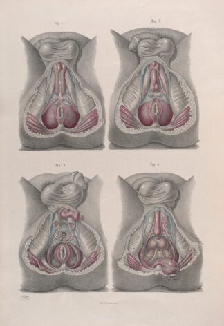 Surgical anatomy Pl.43 by Joseph Maclise