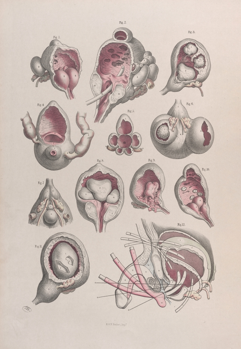 Surgical anatomy Pl.47 by Joseph Maclise